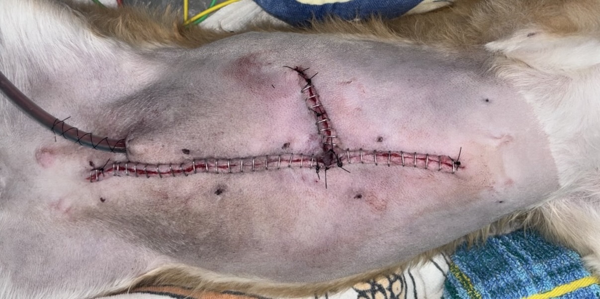 開腹- 副腎摘出術