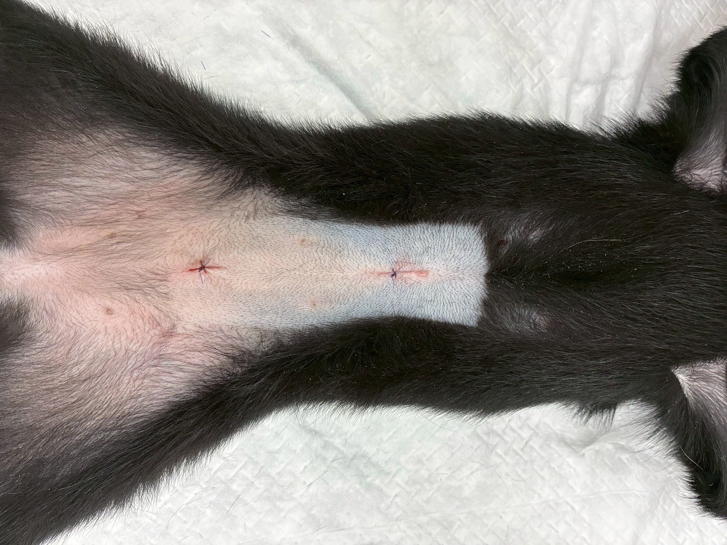 腹腔鏡- 避妊手術