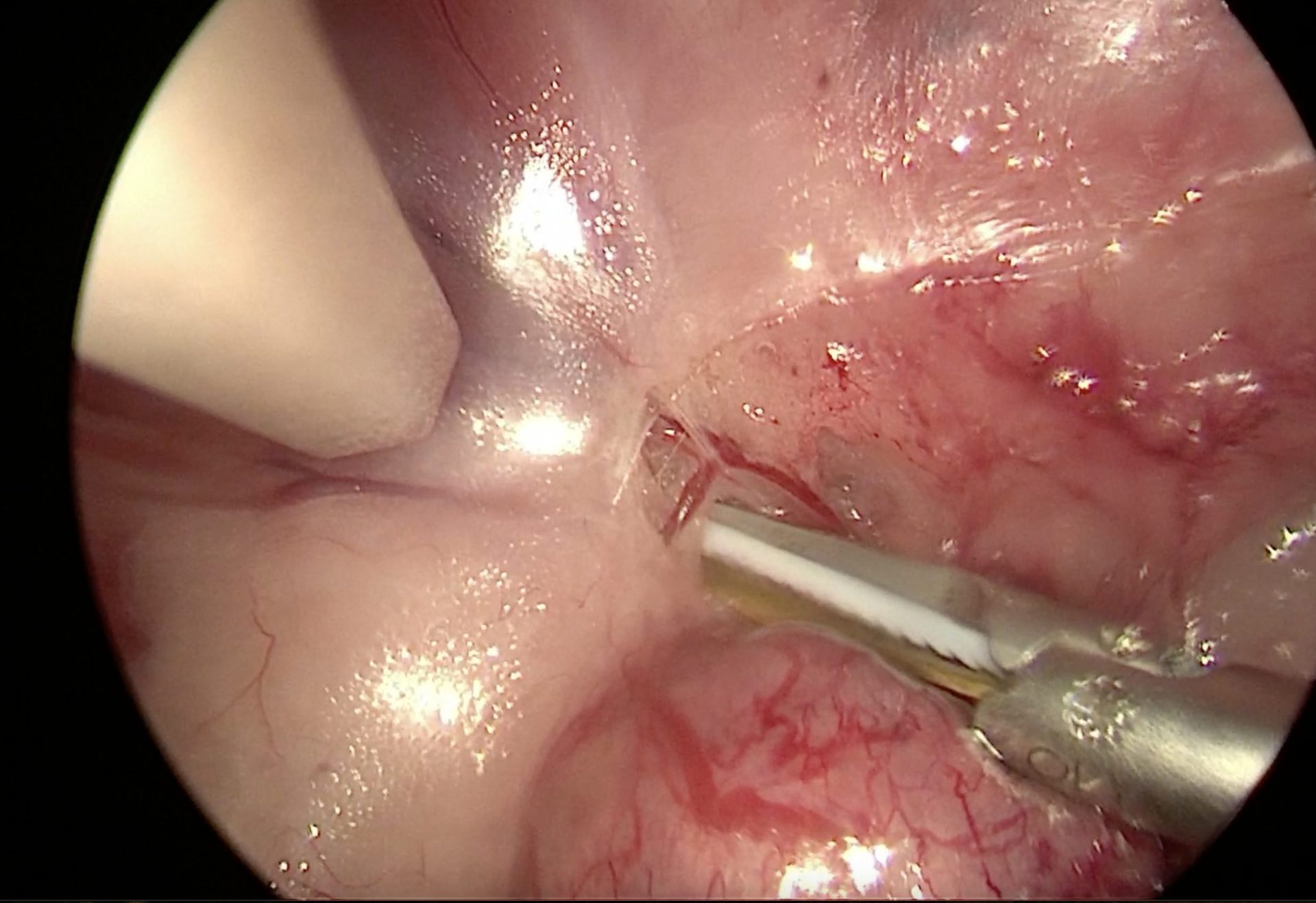 繊細で正確な手術