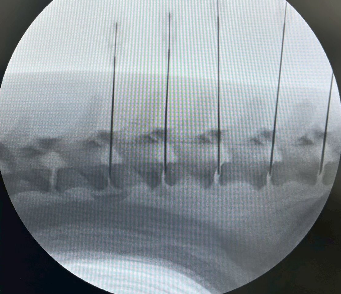 複数箇所も同時に治療