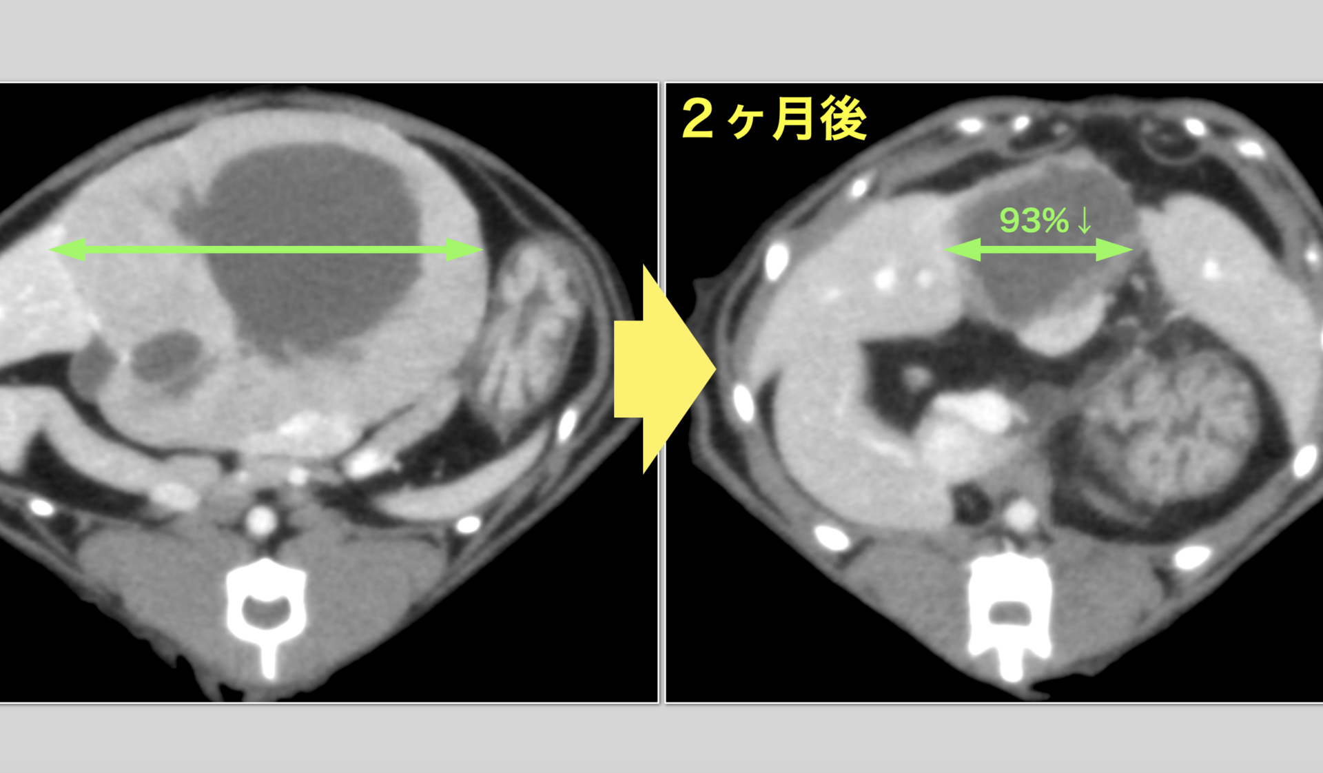 腫瘍に絶大な効果