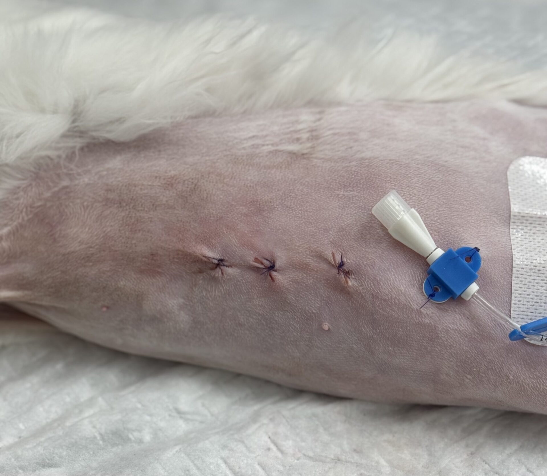 痛みの少ない手術