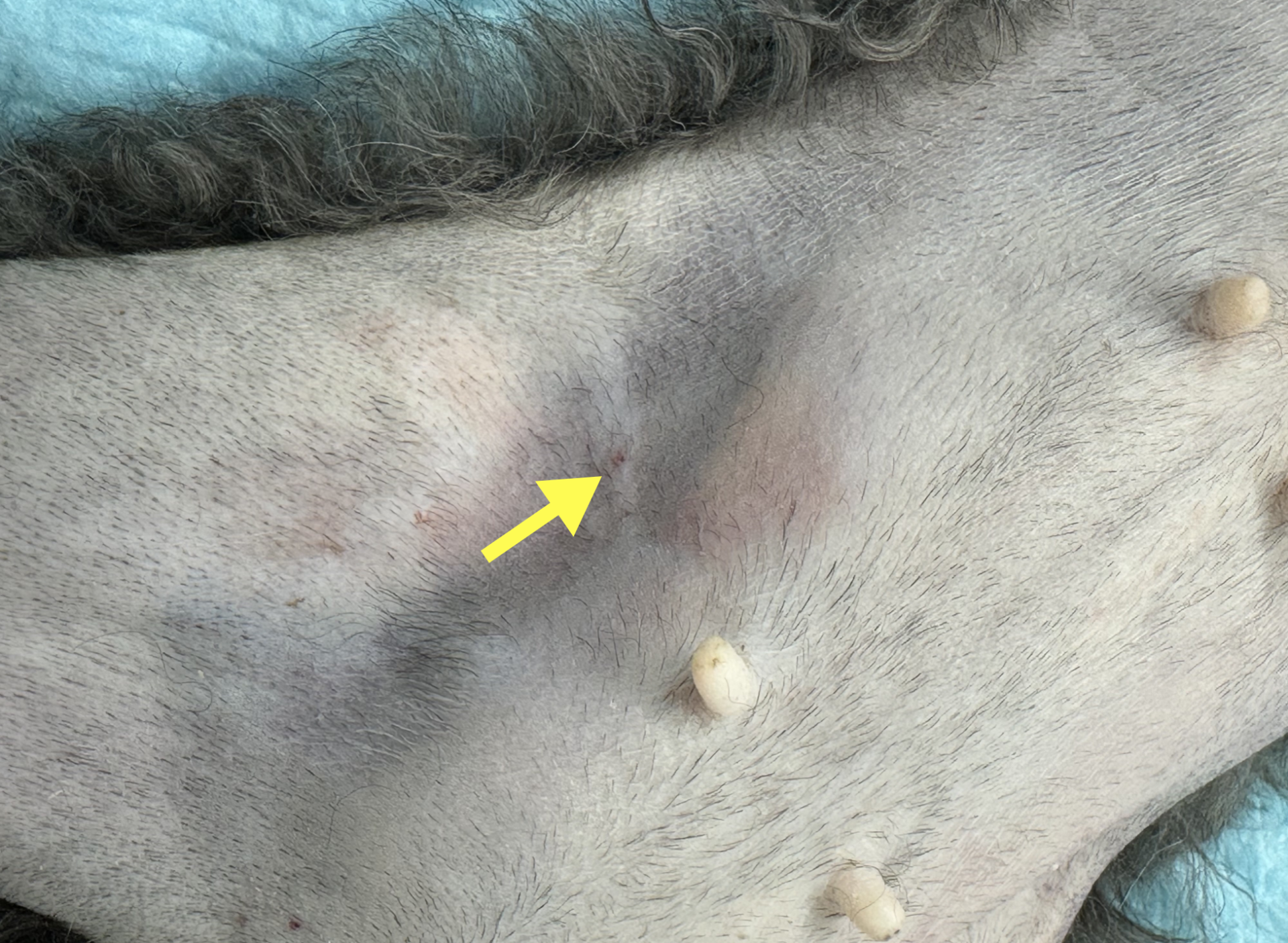 痛みの少ない手術